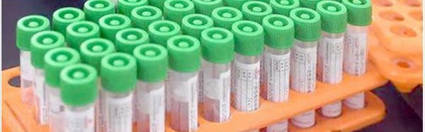  网坛新科技助力训练，智能穿戴设备成标配